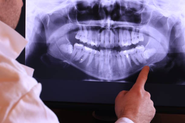 Best Emergency Root Canal Treatment in Dumas, TX