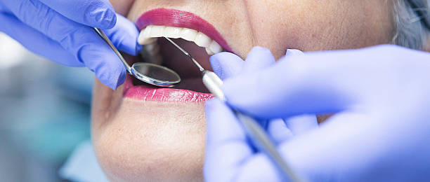 Best Emergency Broken Tooth Repair in Dumas, TX